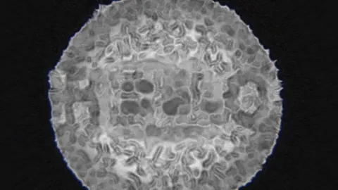 Localized Attraction-Repulsion (LAR)